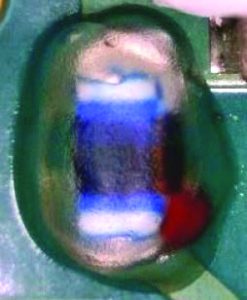 Figure 6: Pre-coating on inductor